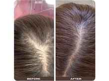 リリーグレース(Lily Grace)/スカルプケア(部分)