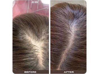 リリーグレース(Lily Grace)/スカルプケア(部分)