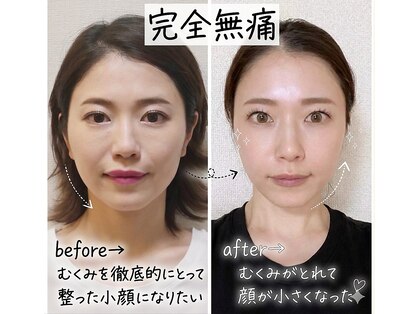 ル フラーズ(Les Fleurs)の写真