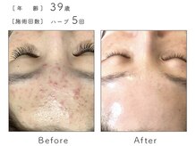 サロン バイオビオ(SALON BioBio)/