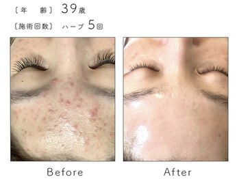 サロン バイオビオ(SALON BioBio)/