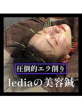 ルディア 堀江店(ledia)/エラ張りのお悩みは美容鍼