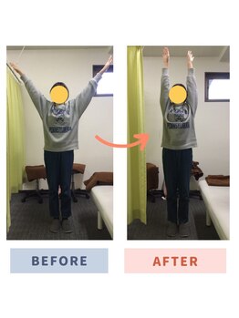 アミーゴ整体院/ビフォーアフター