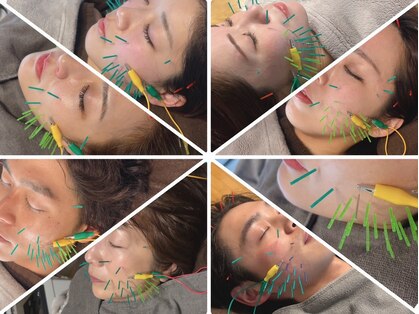 ラムールボーテ(L'AMOUR BEAUTE)の写真