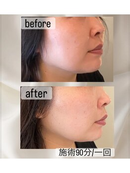 ピーロ ルレ(salon Piilo Rule)/結果を出したい方へ