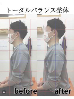 鶴間駅前鍼灸院 整骨院/施術のbefore after