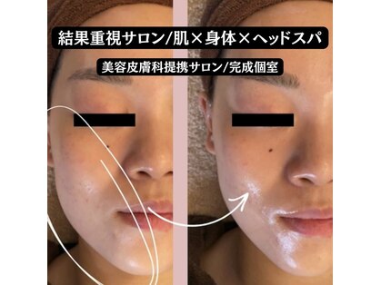 シェリー(CHERIE)の写真