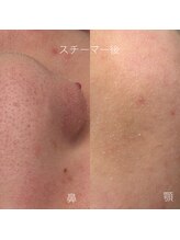 レア(Lea)/汚れ！奥に潜んでます！