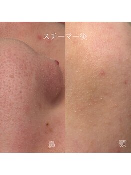 レア(Lea)/汚れ！奥に潜んでます！