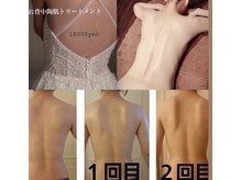 マヤヒメ(mayahime)/お背中REVIハーブピーリング