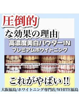 ホワイトニングサロン ホワイト(WHITE)/ホワイトニング/大阪/福島