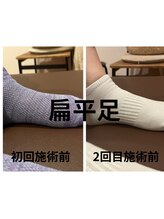 熊本カワル整体 JR上熊本駅院/偏平足