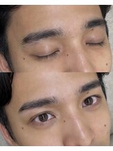 ギュイ(gui)/before after