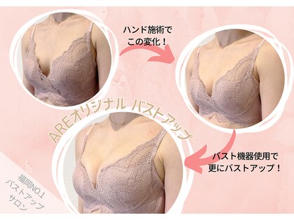 アーレ 福岡天神店(ARE)の写真