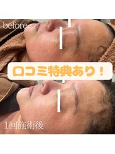 レヴール(reveur)/フェイシャルケア