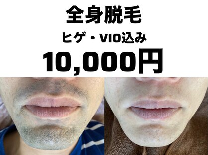 美痩身(bisoshin)の写真