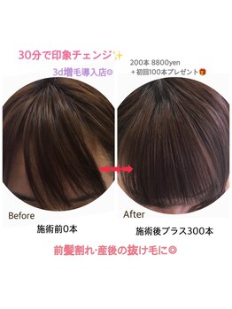 エリアジェイ(Aria.J)/3D増毛導入♪30分でお悩み解決☆