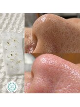 ソート(THOUGHT)/毛穴エクストラクションtete式