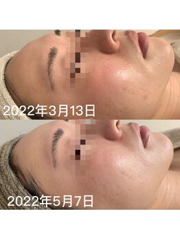 ナヴィータ アオバダイ(Navita AOBADAI)/エンビロン/2ヶ月集中コース