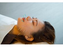 デルタエヌピー63+(δnp63+)/お客様施術例【小顔/薬院/福岡】