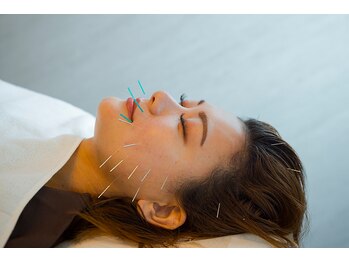 デルタエヌピー63+(δnp63+)/お客様施術例【小顔/薬院/福岡】