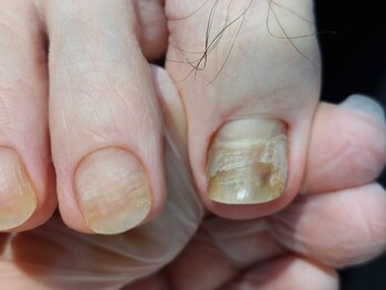 爪切り屋 足楽/40代男性その２　→