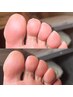 【フットケア】乾燥で白くなった踵を見せられるぷるぷる足に♪80分の極上ケア