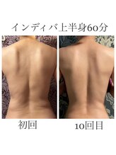 プラチナローズ(Platinum Rose)/インディバボディ