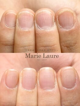 マリーロール 淀屋橋本店(Marie Laure)/自爪育成/深爪矯正/ネイルケア