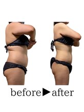 スタイルアップボディ ナゴミ(スタイルアップBODY！NAGOMI)/10ｋｇ以上がっつり痩せたい方！