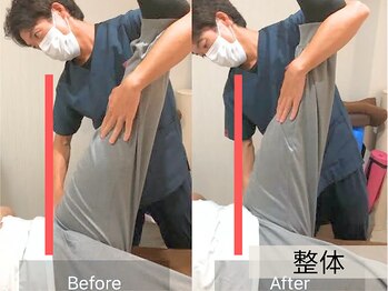 リミッション(ReMission)/整体後の効果