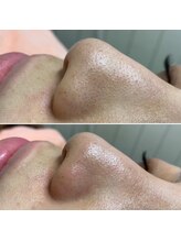 パッチ バイ サロンデヤンス(Patch by SALON DE YANSU)/