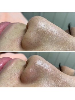 パッチ バイ サロンデヤンス(Patch by SALON DE YANSU)/