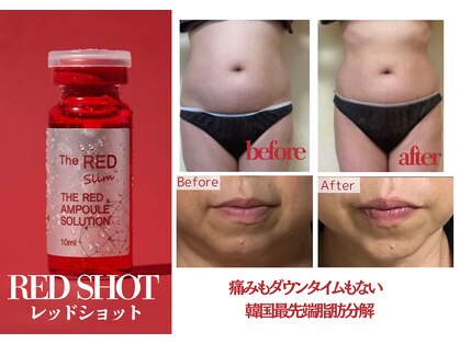 ラフィリス(RAFFILICE)の写真