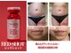 ラフィリス(RAFFILICE)の写真