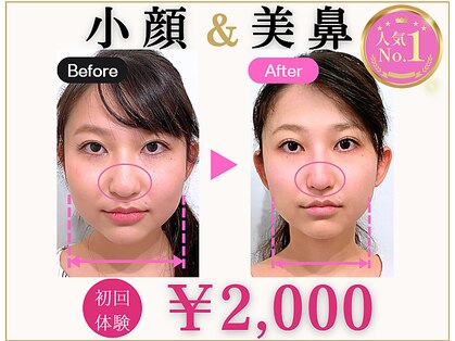 ラプリアンジュ 鹿児島天文館店(Raplit ange)の写真