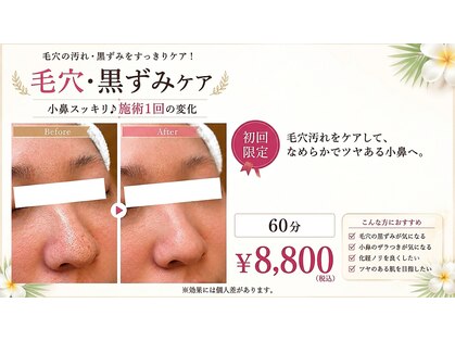 エステティックリゾート オルオル(oluolu)の写真