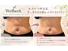 ウェルシーク(Wellseek)の雰囲気（1回の施術で子の効果！腸の動きを高め、代謝UPします。）