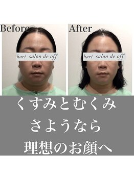 ハリサロンドオフ 心斎橋店(hari salon de off)/くすみとむくみにさようなら☆