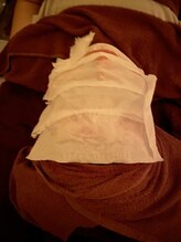 チャンプ 高の原店(Champ)/噂の炭酸ガスパック