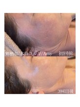 エイミー(Amy)/長年悩み[もたつきスッキリ解消]