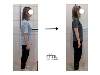 叶'エル 本町 心斎橋院/産後骨盤矯正