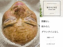 サロンドリー(salon de Re)の雰囲気（[ハーブピーリング/肌質改善/ニキビケア/毛穴/ブライダルエステ]）