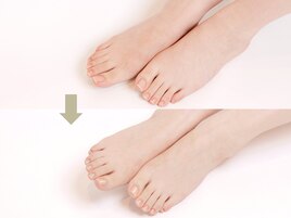 足先のエイジングケア