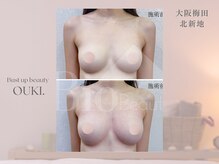 【育乳・バスト専門×女性らしさを磨く】OUKI. 梅田北新地【3月1日 OPEN（予定）】/バストアップ結果写真