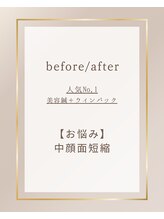 ミプラス鍼灸スタジオ/ビフォーアフター