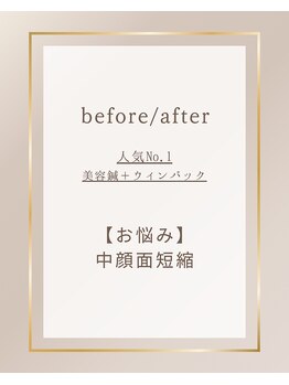 ミプラス鍼灸スタジオ/ビフォーアフター