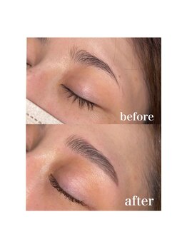 ボアップ(boappu)/Bivi brow lift