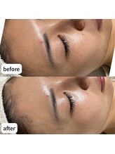 ルアラナ(Lualana)/紫外線ダメージやシミくすみケア