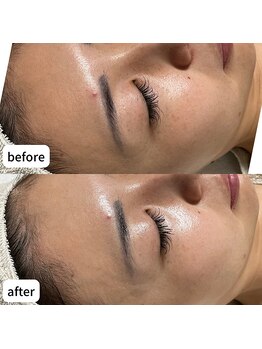 ルアラナ(Lualana)/紫外線ダメージやシミくすみケア